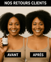 Huile Repousse Express : Cheveux & Barbe ( 50% réduction + Livraison GRATUITE )