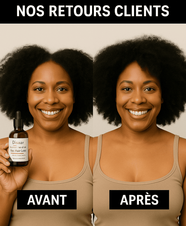 Huile Repousse Express : Cheveux & Barbe ( 50% réduction + Livraison GRATUITE )