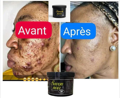 Savon Noir Anti-Tâche Ô Marché